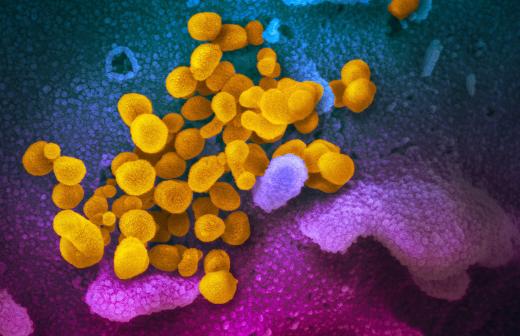Ученые назвали вероятные пути распространения вируса Nipah<br />
